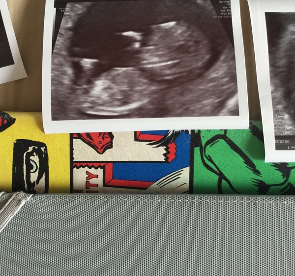 Scan pic? What gender is my baby..