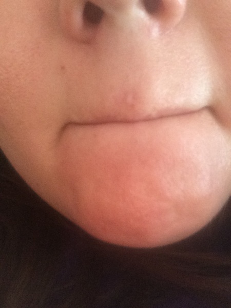 what is this on my face??? (pic attached)