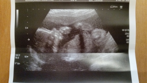 December 2016 babies - thread #4 - blooming in trimester 2!