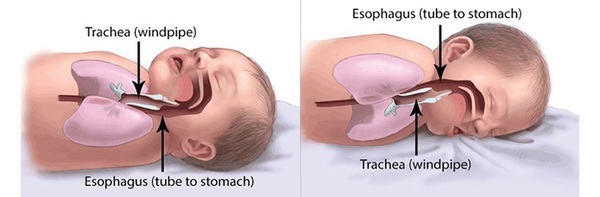 Which is the safer newborn sleeping arrangement?
