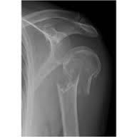 To think this is an obvious fracture? Pic