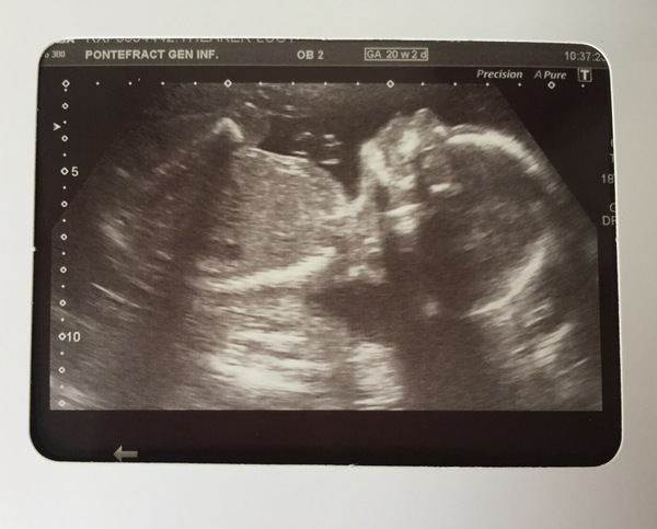 December 2016 babies - thread #4 - blooming in trimester 2!