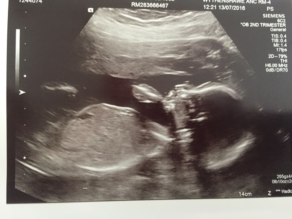 December 2016 babies - thread #4 - blooming in trimester 2!