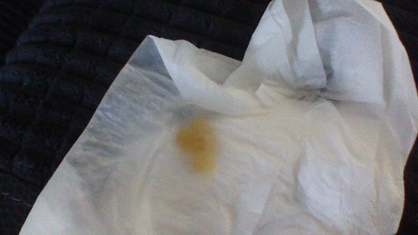 KLAXON- Persistant cough with mucus (warning-pic included)