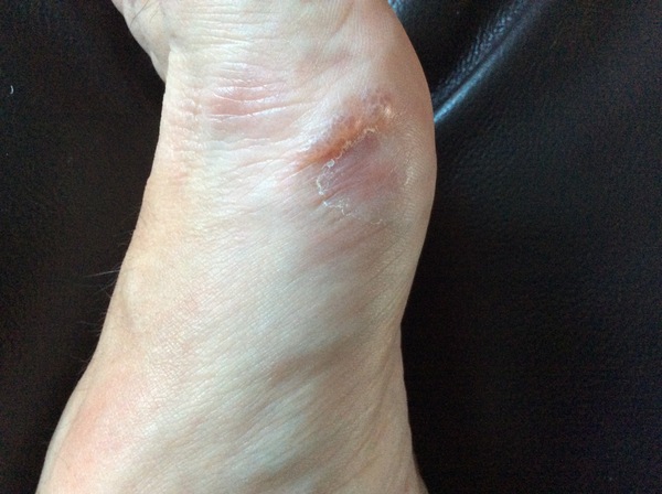 What the heck is wrong with my feet
