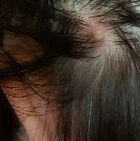 My head is killing me!!!