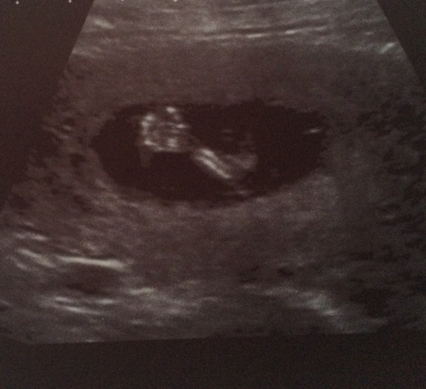 February 2017 - Thread 4 (are we the chattiest bunch or what?!)