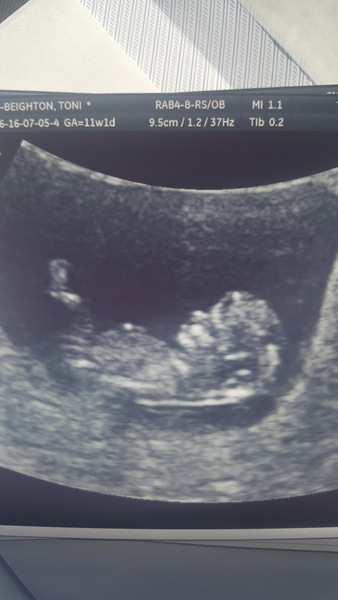 Staying posifrickentive- Thread 9 for ladies pg after mc