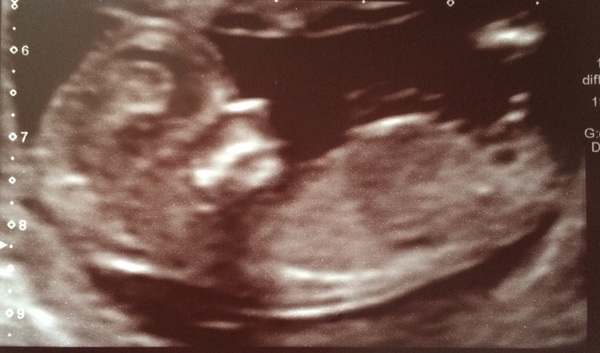 Staying posifrickentive- Thread 10 for ladies pg after mc