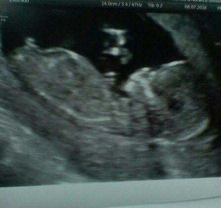 Boy or Girl???