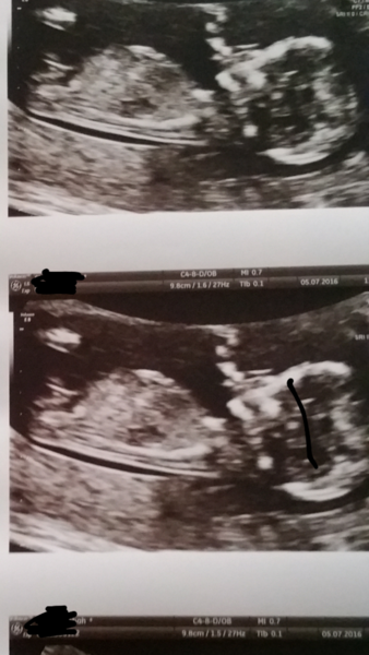 Gender guess.