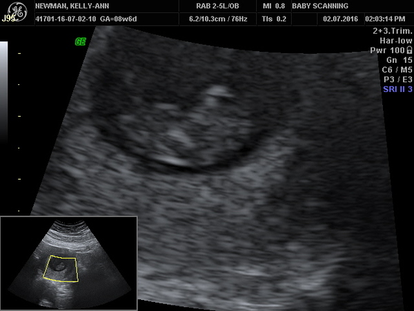 Due in February 2017...thread #3!