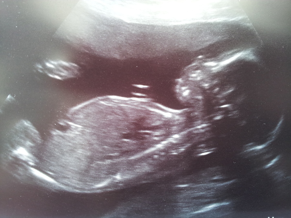 Thread #8 - TTC#1 Grads - stripy bump photos ahoy!