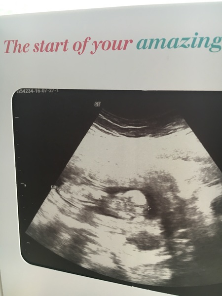 February 2017 - Thread 4 (are we the chattiest bunch or what?!)