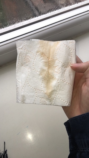 (Graphic img) why does this keep happening?