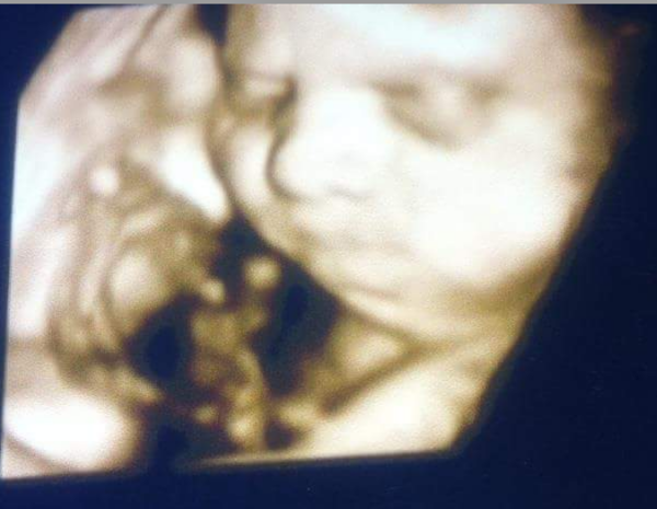 3D 4D scan