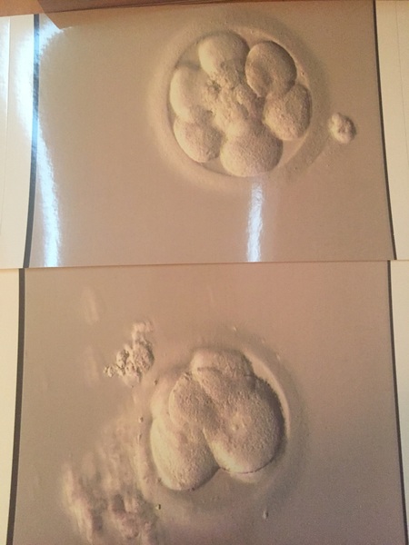 Trying to conceive for 10 months or more. Thread 5. All ten plussers welcome.
