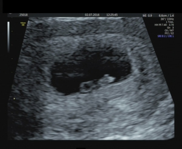 Due in February 2017...thread #3!