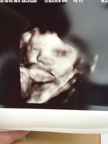 Thread #8 - TTC#1 Grads - stripy bump photos ahoy!