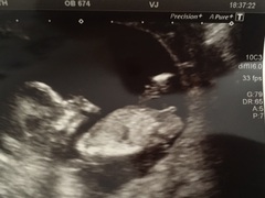 Boy or Girl???