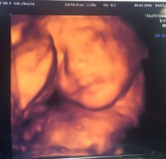 Thread #8 - TTC#1 Grads - stripy bump photos ahoy!