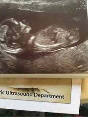 Boy or Girl???