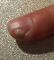 Er, my finger looks like it is going green. <pic!>