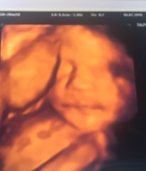 Thread #8 - TTC#1 Grads - stripy bump photos ahoy!