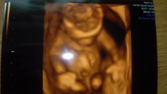 December 2016 babies - thread #4 - blooming in trimester 2!