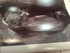 Boy or Girl???