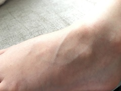 Under weather and rash on tops feet - with pics