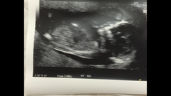 Gender guess??