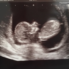 Boy or Girl???