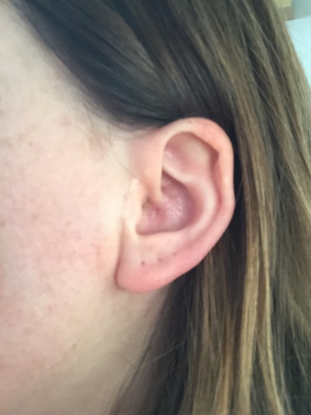 If you had this physical 'quirk' would you try and rectify it? AIBU and superficial?