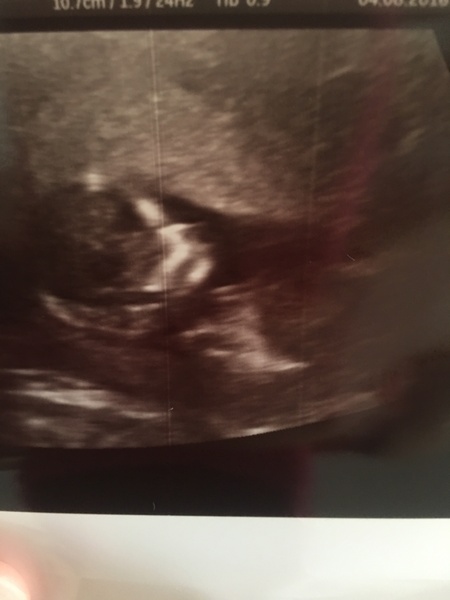 Due in February 2017....thread 5!