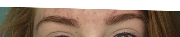 PLEasE heLP! Awful eyebrow tint job!