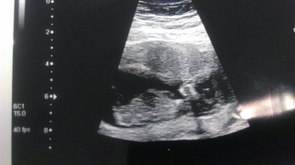 Due in February 2017....thread 5!