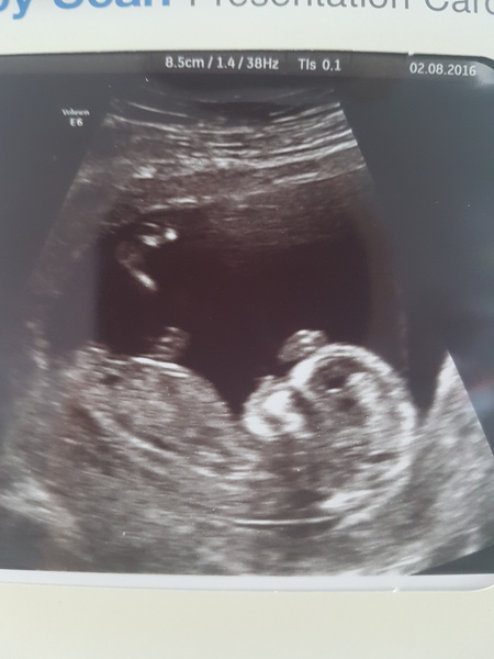 Another gender prediction PLEASE :-)