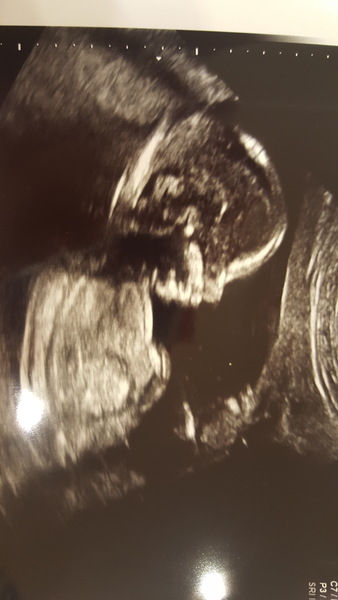 Due February 2017- thread #6