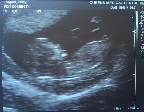 Due in February 2017....thread 5!