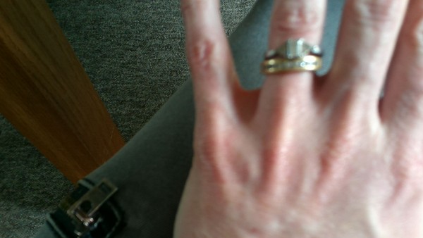 Photos of engagement rings