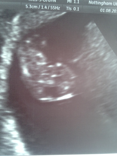 March 2017 - Thread #2