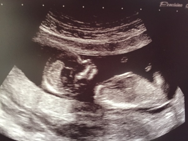 Due in February 2017....thread 5!