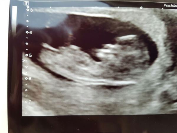 Due in February 2017....thread 5!