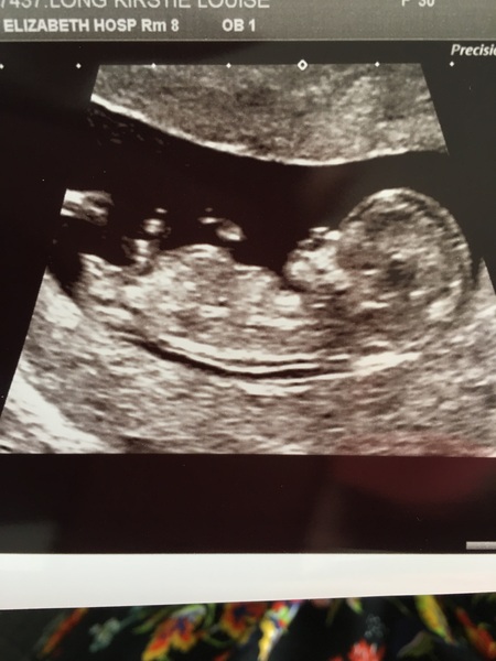 Due in February 2017....thread 5!