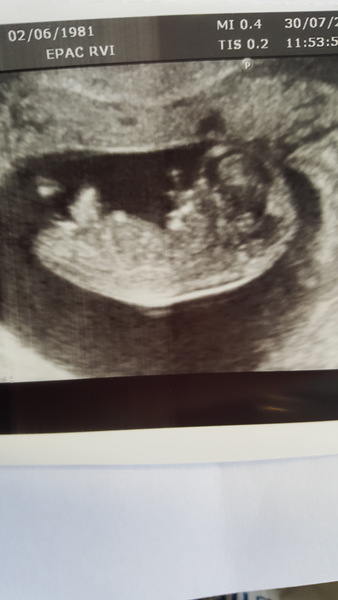 Due in February 2017....thread 5!