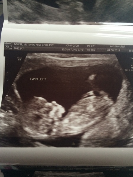 Due in February 2017....thread 5!