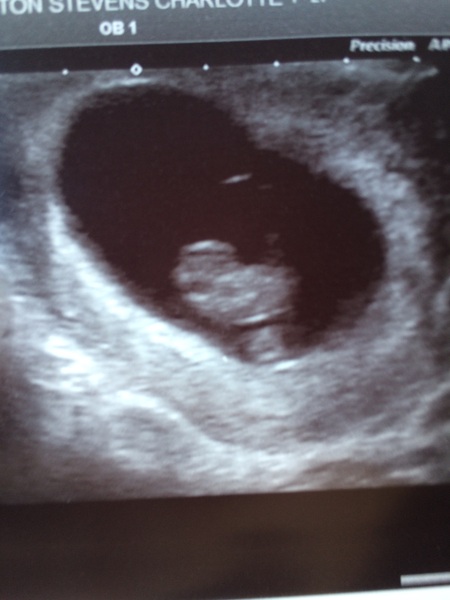 March 2017 - Thread #2