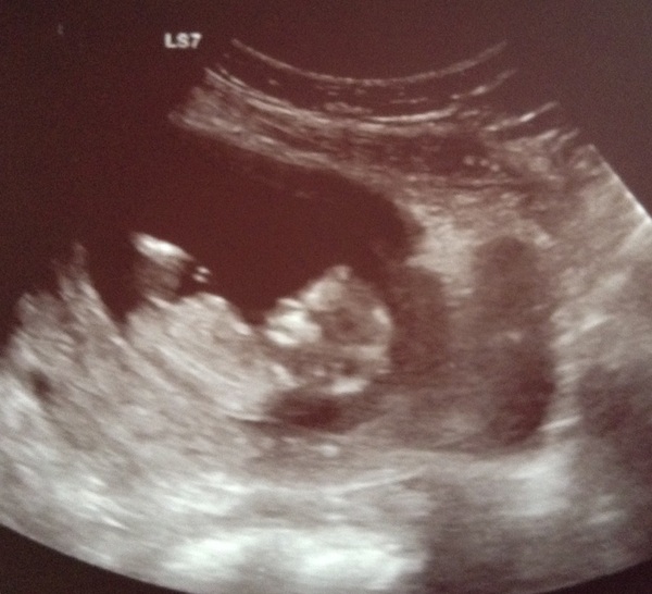 Gender guess please