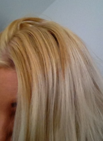 Hairdresser burnt scalp banana roots